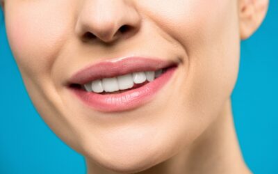 How long does it take to see results from professional teeth whitening?