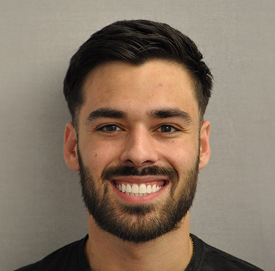 Invisalign Case