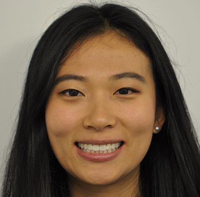 Invisalign Case