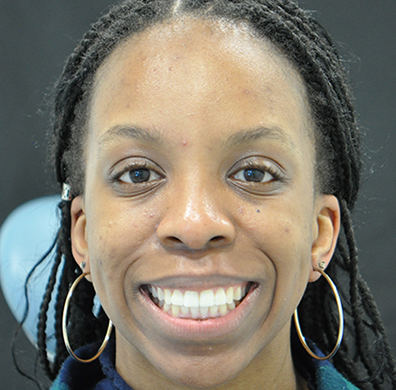 Invisalign Case