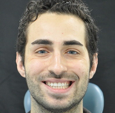 Invisalign Case