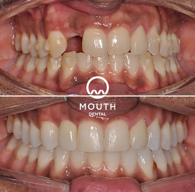 Patient Case