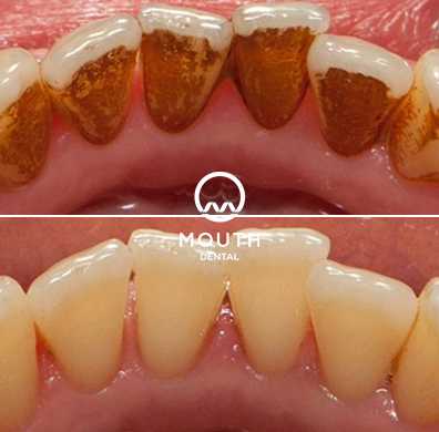 Patient Case