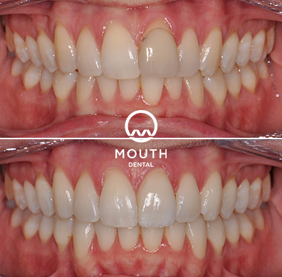 Patient Case