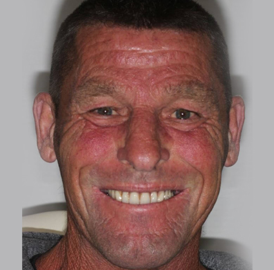 Patient Image