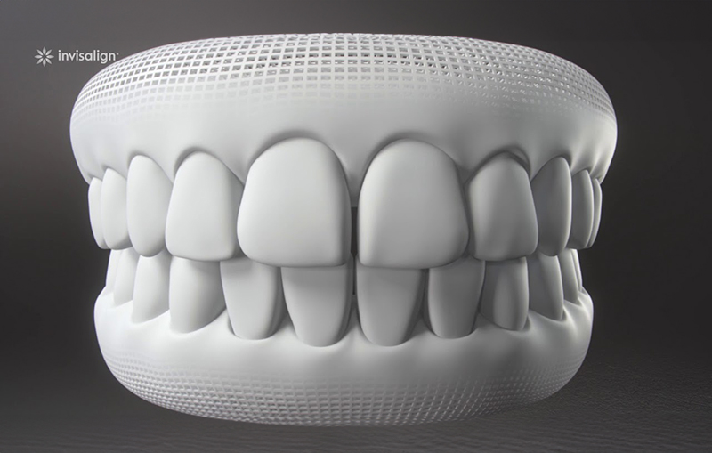 Invisalign